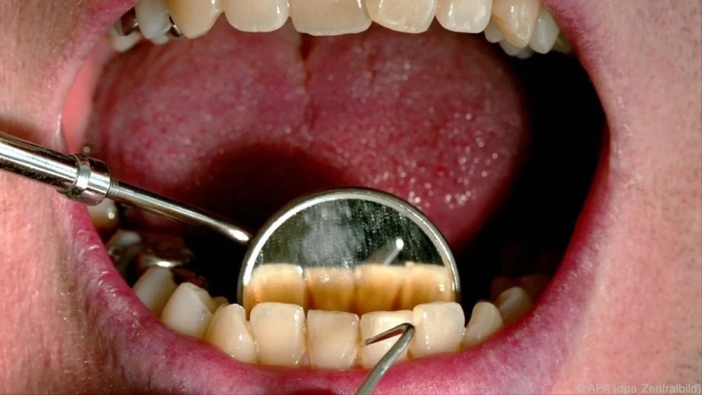 نتائج مفاجئة.. تأثير عدم العناية بالأسنان على الصحة العامة